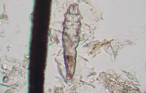 Demodex canis mite Demodex canis mite