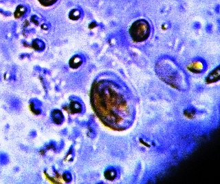 Giardia Cysts